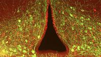 arcuate research image from a microscope